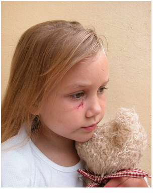 PTSD and child abuse